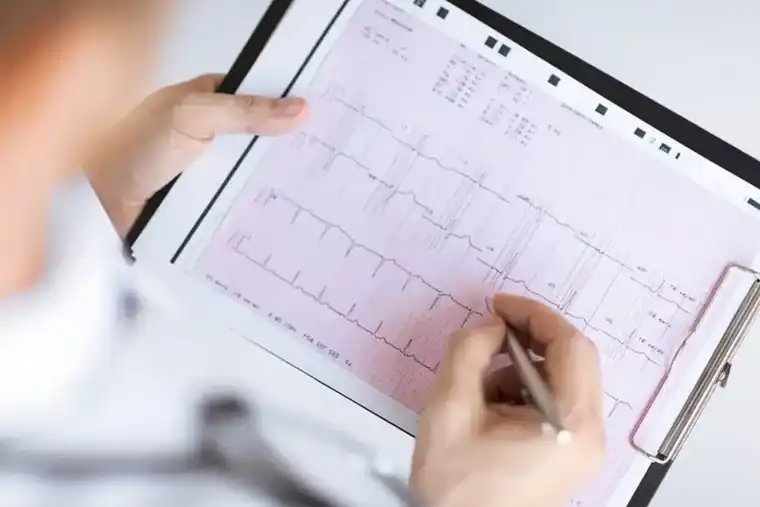 EKG-reading