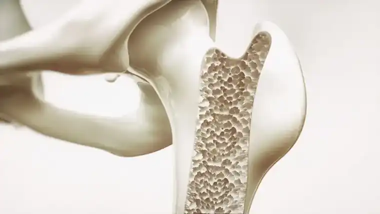 Bone Density Scan in South Florida