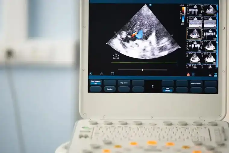 Things to Know About Echocardiograms
