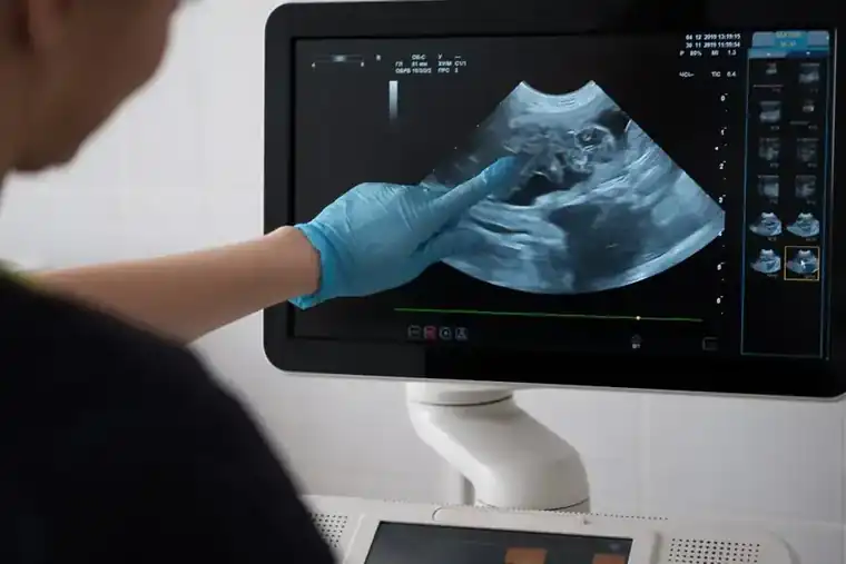 Why You Should Have an Ultrasound When You’re Pregnant
