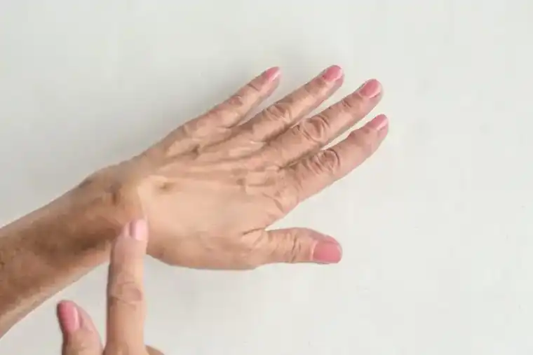 Be on the Safe Side; See Your Doctor Whenever You Notice a Mass on Your Hands or Feet