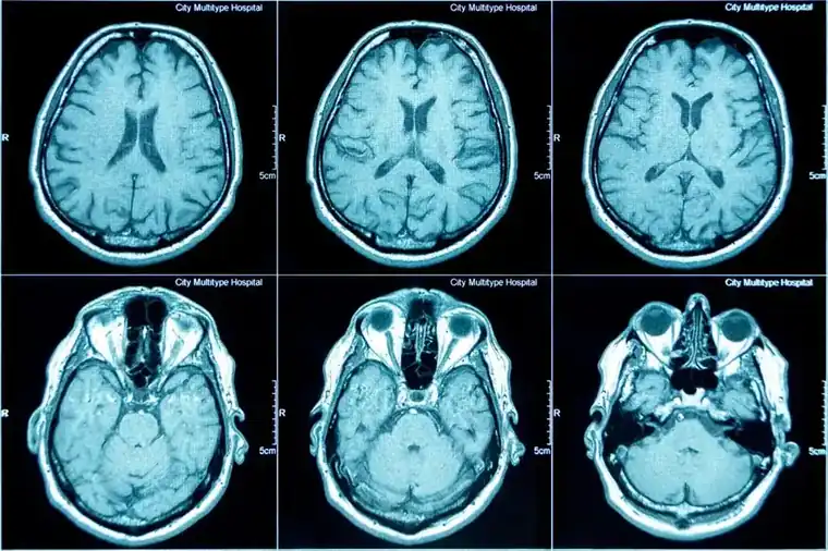What Diseases Do CT Scans Detect?