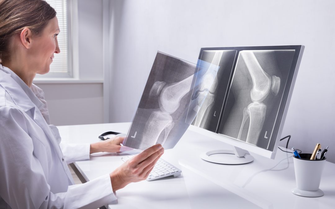 Hollywood Diagnostics Center Helps You Prepare for Your X-Ray