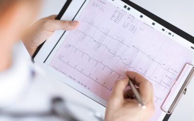 Important Facts About EKGs