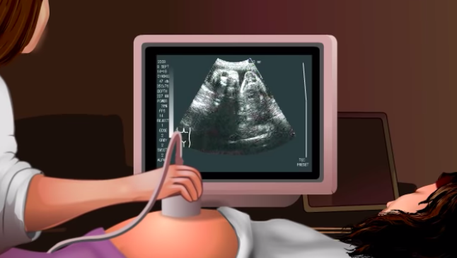 Getting Your Ultrasound at Hollywood Diagnosticss