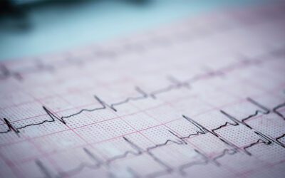 What Are the Differences Between EKGs & Echocardiograms