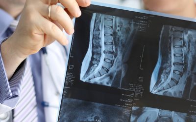 Important Facts About X-Rays
