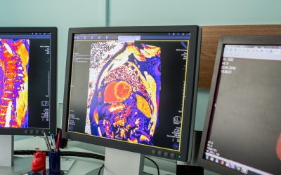 What are the Differences Between an MRI and a CT Scan?