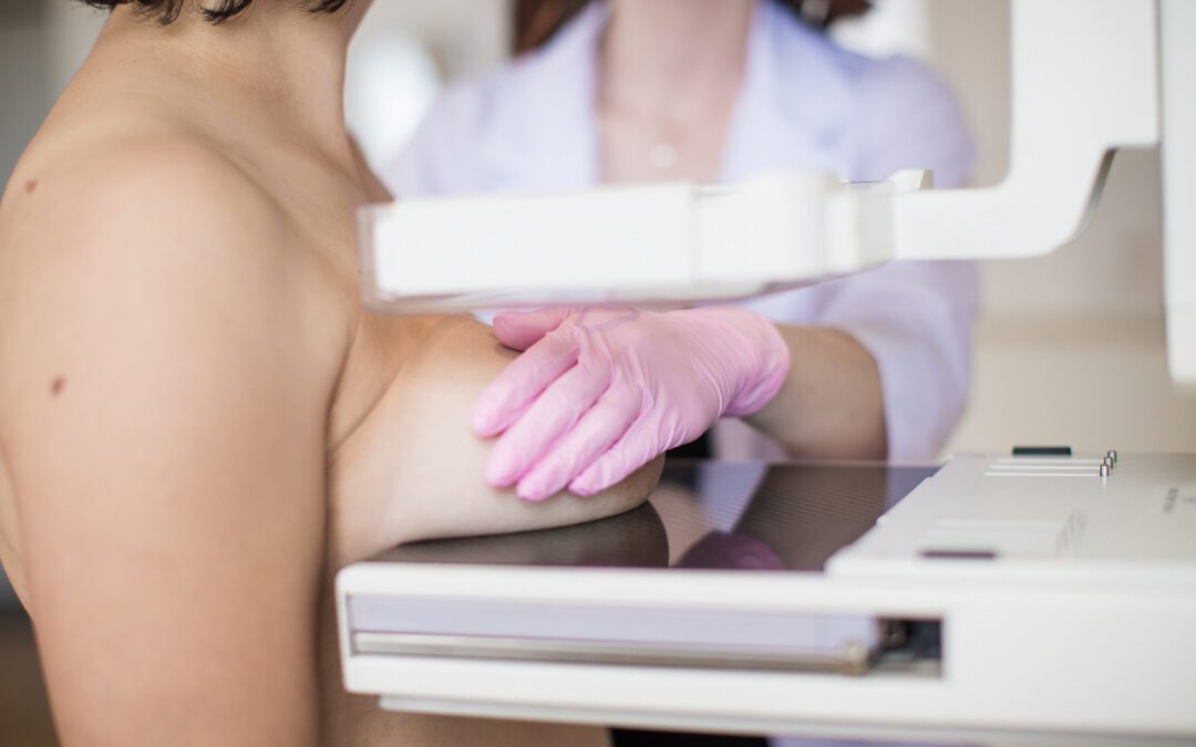 Mammograms: When to Get One and What to Know