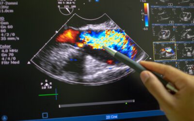 FDA Clears Echocardiography AI to Aid in Fight Against Coronary Artery Disease