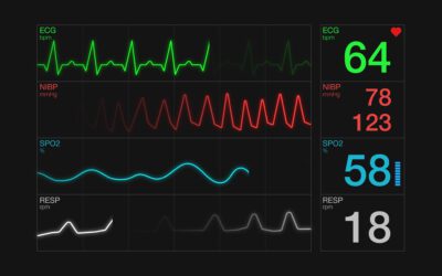 HDC Shows the Differences Between Echocardiograms & EKGs