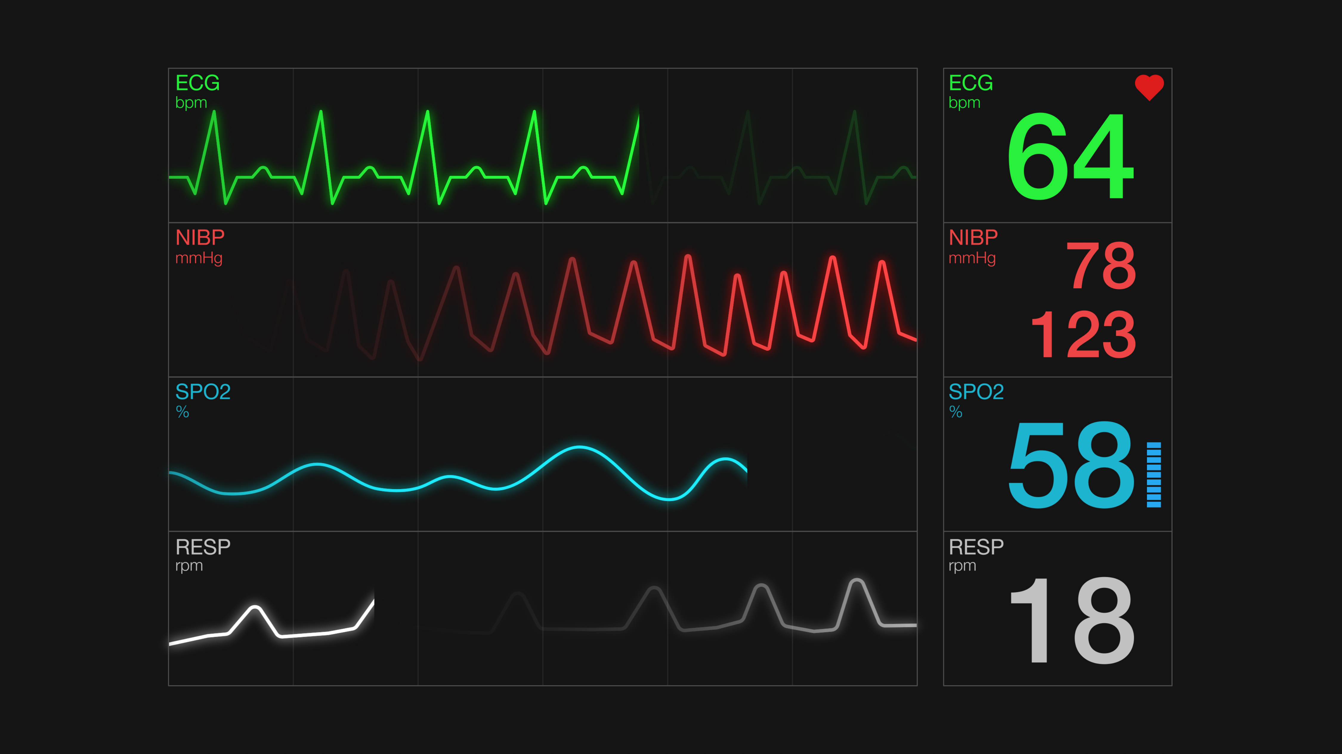 HDC Shows the Differences Between Echocardiograms & EKGs