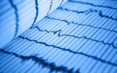 Echocardiograms & EKGs Explained by Hollywood Diagnostics Center