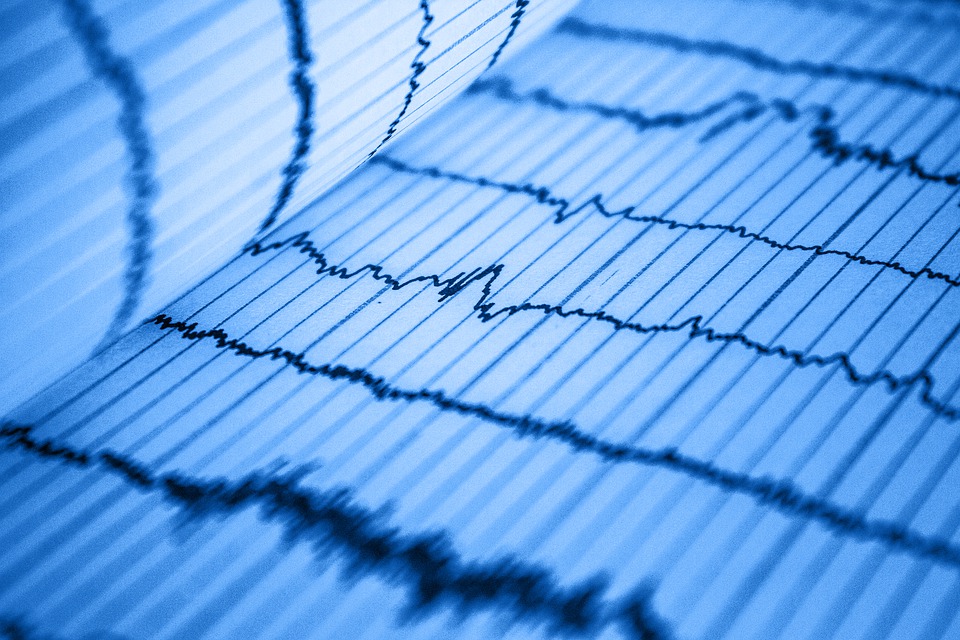 Echocardiograms & EKGs Explained by Hollywood Diagnosticss Center