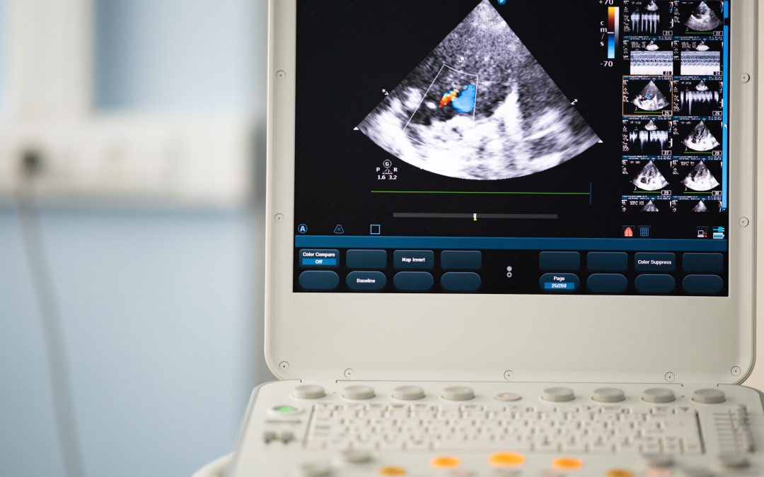 Things to Know About Echocardiograms