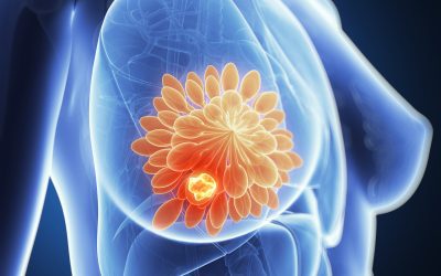 Learning How to Recognize Signs of Breast Cancer
