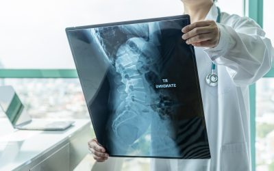 MRI Versus X-ray, Understanding the Difference