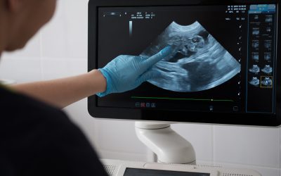 Why You Should Have an Ultrasound When You’re Pregnant
