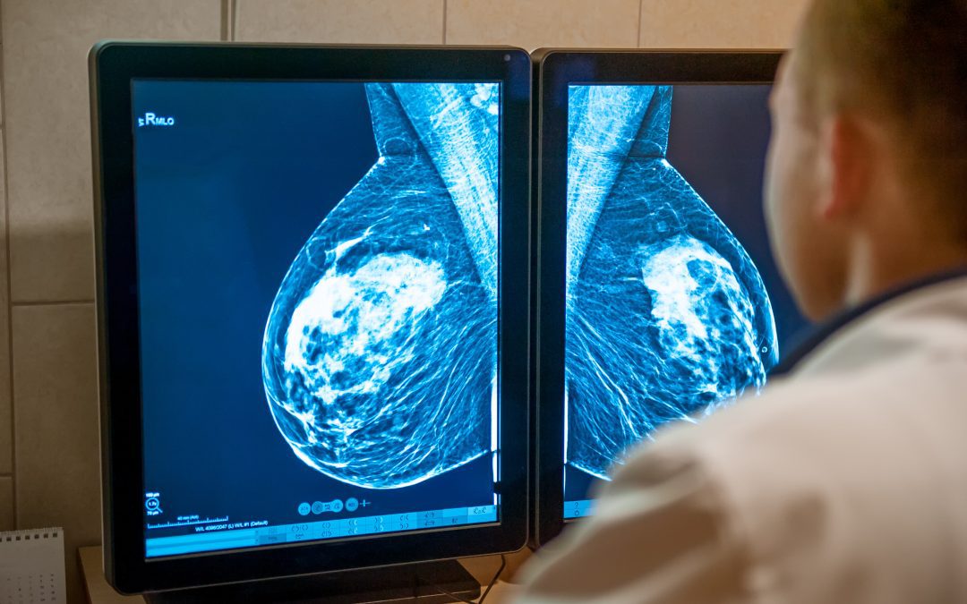 Why You Should Have Routine Mammograms