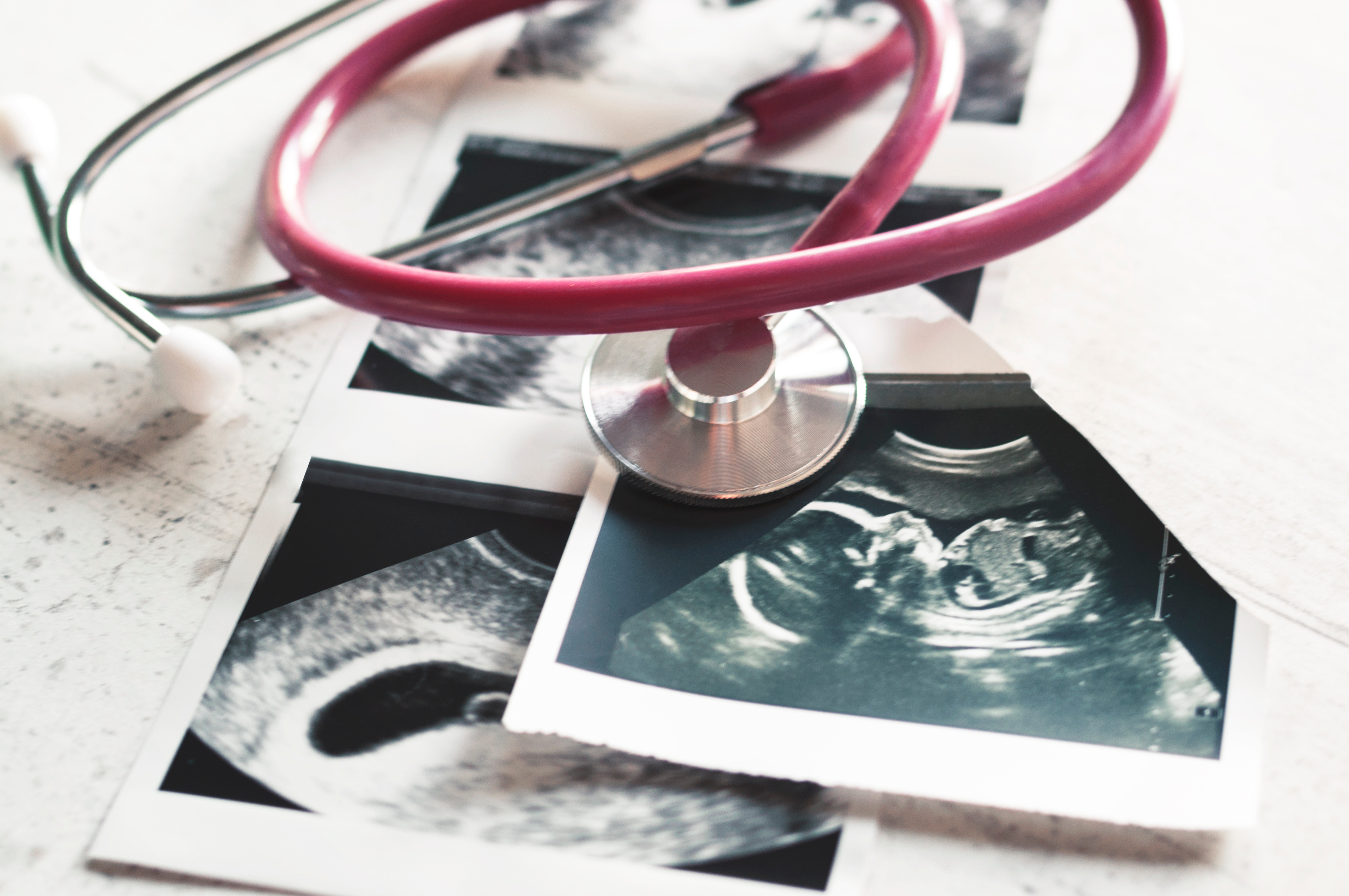 Having a Baby in South Florida? Here’s Why You Should You Should Choose Hollywood Diagnostics for Ultrasounds!