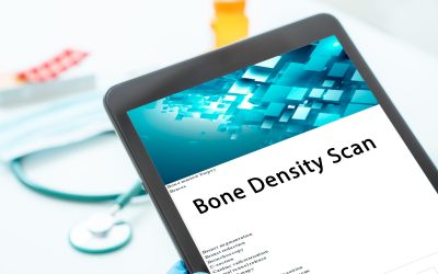 The Importance of Bone Density Scans When Aging: Spotlight on Hollywood Diagnostics