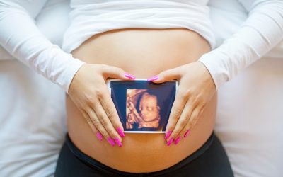 Why You Should Have Routine Ultrasounds at Hollywood Diagnostics for a Safe Pregnancy
