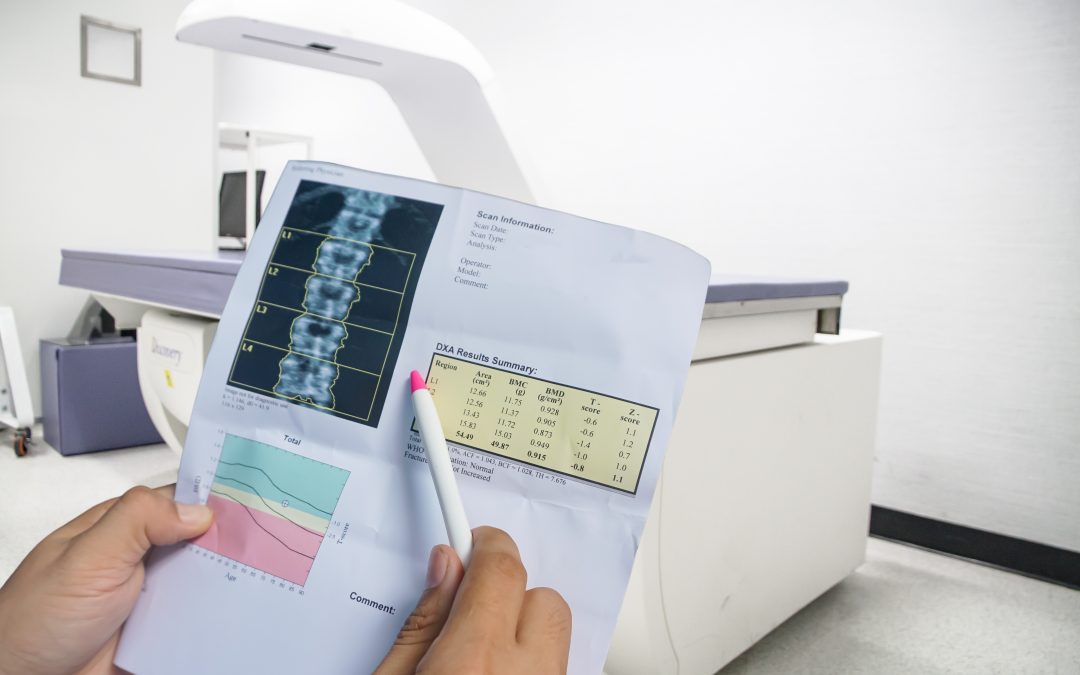 Innovations in Bone Density Scan Tech At Hollywood Diagnostics