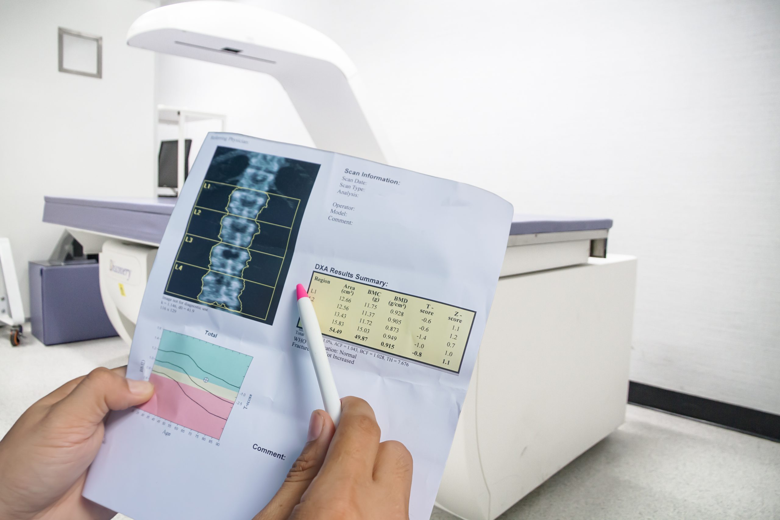 bone density scan, Hollywood Diagnostics