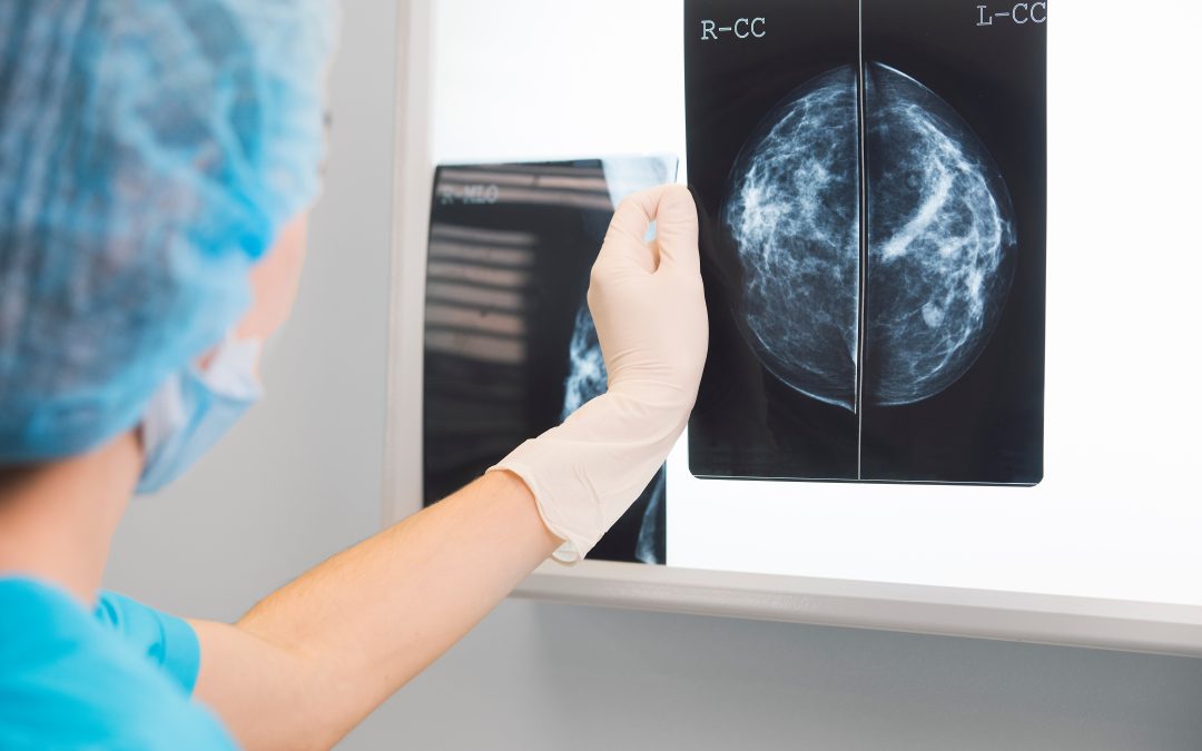 Navigating Breast Cancer Prevention with Advanced Screenings