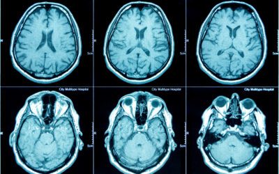 What Diseases Do CT Scans Detect?