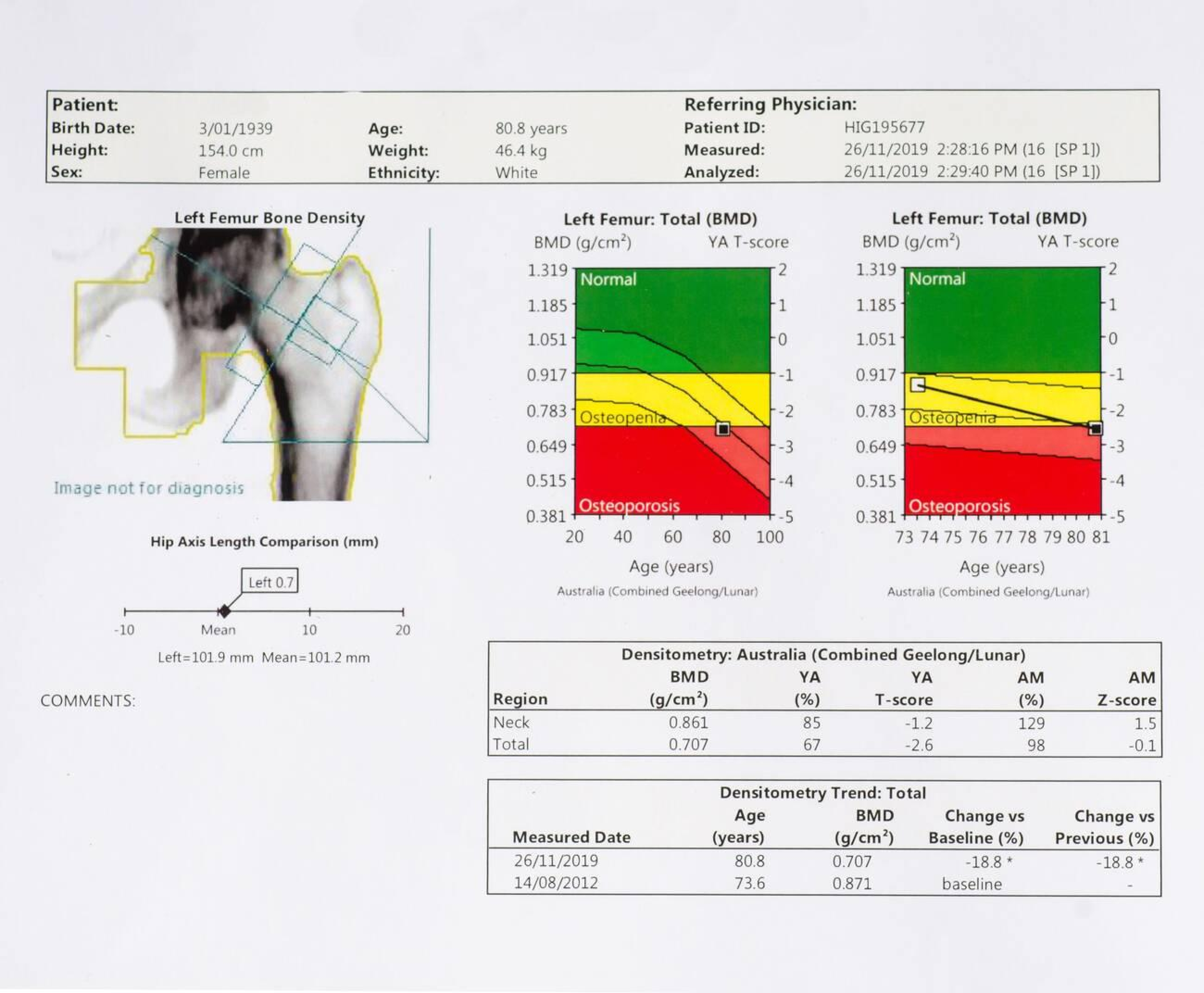 At What Age Should You Get a Bone Density Scan?